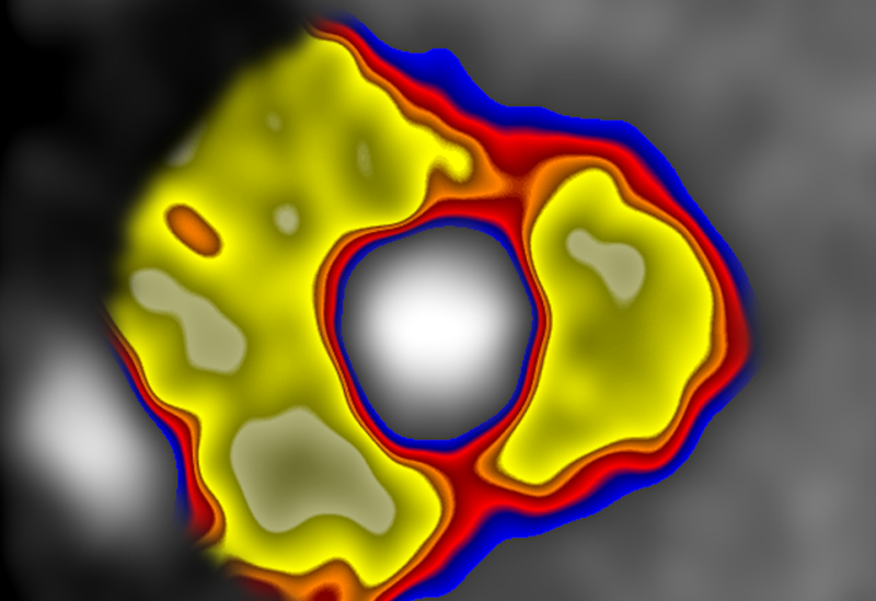 ct-scan-showing-inflammatory-mediators.png