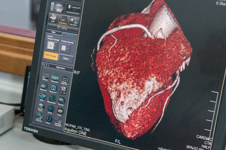 hidden-angina-check-which-can-identify-early-warning-signs.jpg